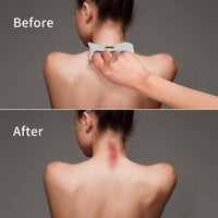 Steel Gua Sha Scraping Tool