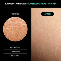Exfoliating Back Scrub Strap